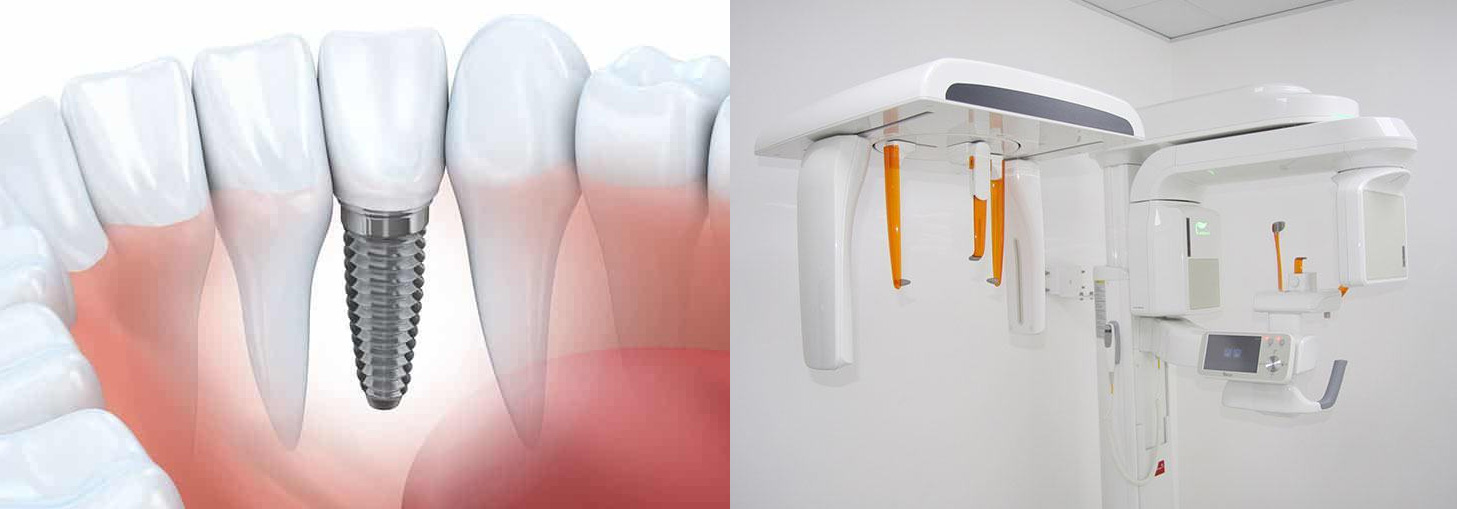 Advanced 3D dental imaging technology