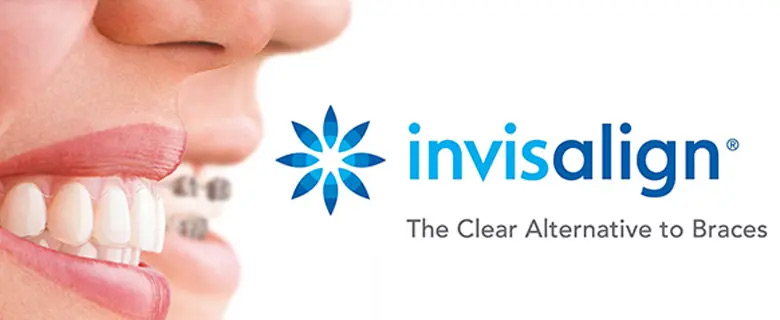 Invisalign Clear Alternative