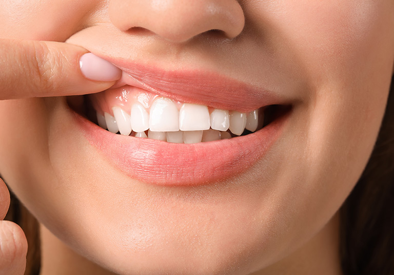 Laser Gum Depigmentation
