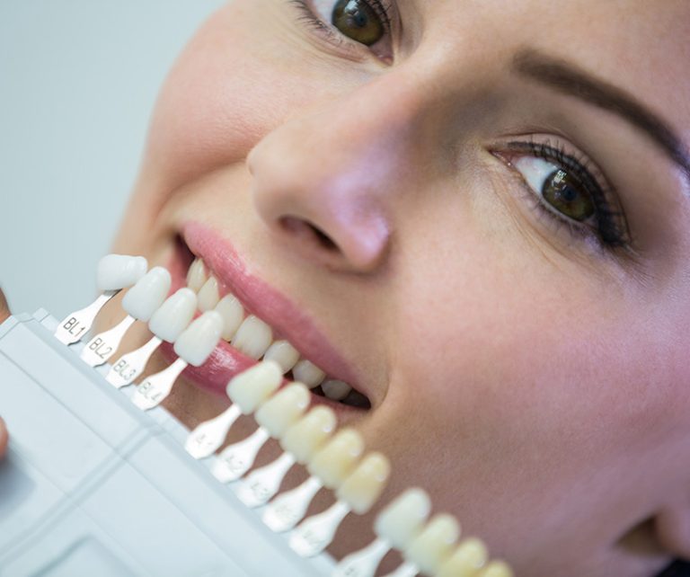 Porcelain Dental Veneers Dubai | Dr Maya Dental Clinic