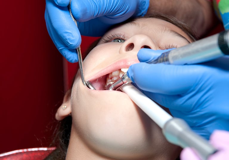 Pulpotomy