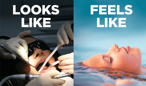 Advantages of IV Sedation
