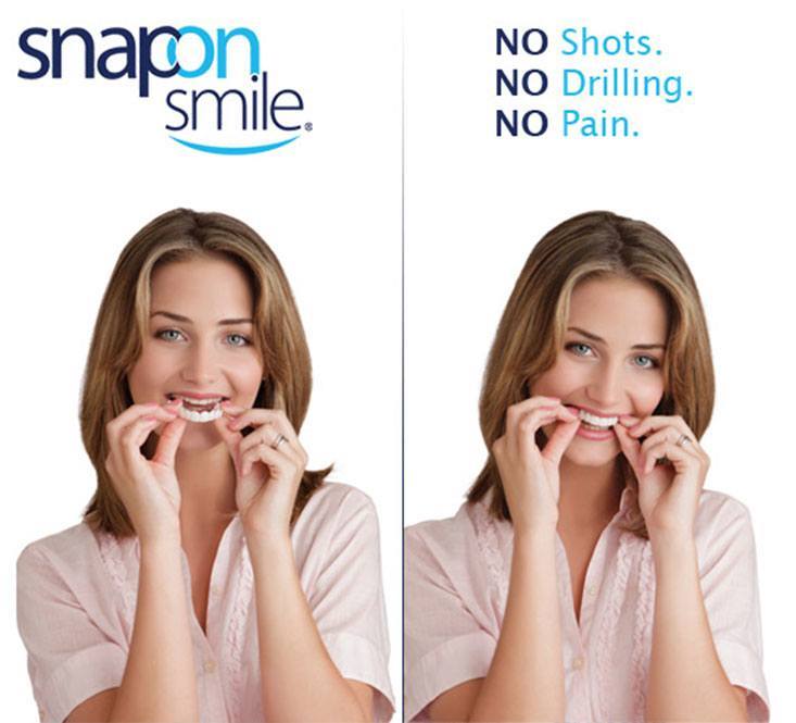 Snap-On Smile