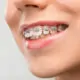 previous thumbnail