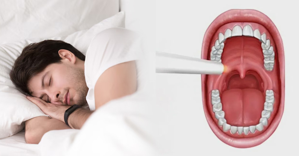 Snoring treatment in Dubai